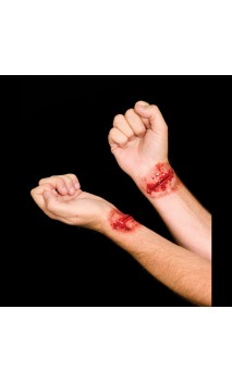 Plaies Poignets Tailladés