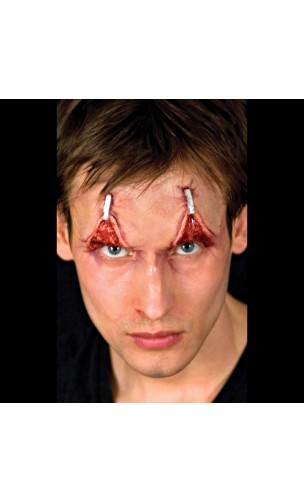 Paupières Retournées avec Agraphes