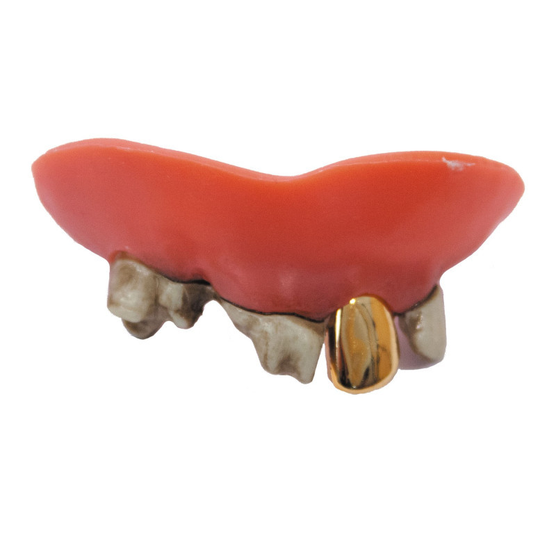 Dentier dents pourries