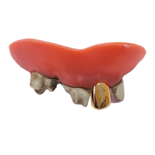 Dentier dents pourries