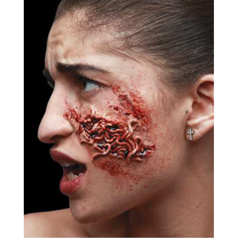 Plaie purulente avec vers