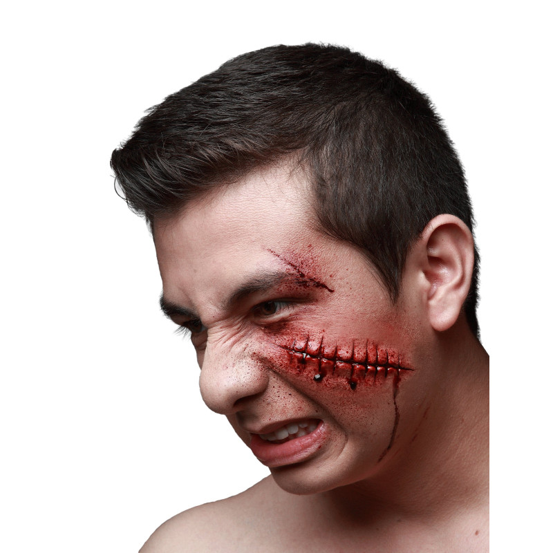 Blessure points de sutures luxe